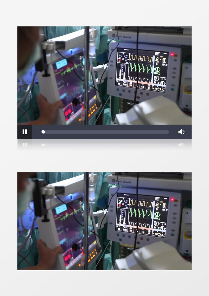 医务人员通过仪器观察病人生命体征实拍视频素材