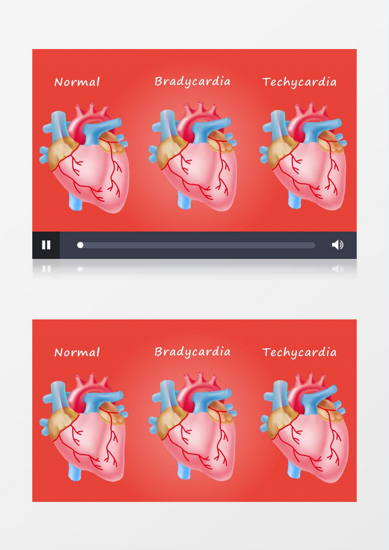 3D动画模拟抽象医疗素材人体心脏跳动手术视频素材