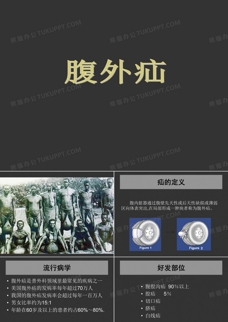 腹股沟疝讲课