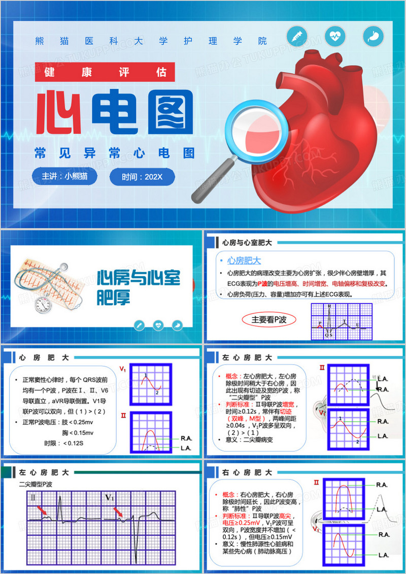 蓝色简约风常见异常心电图PPT模板