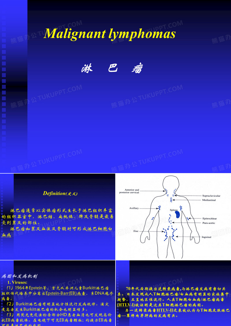 淋巴瘤课件