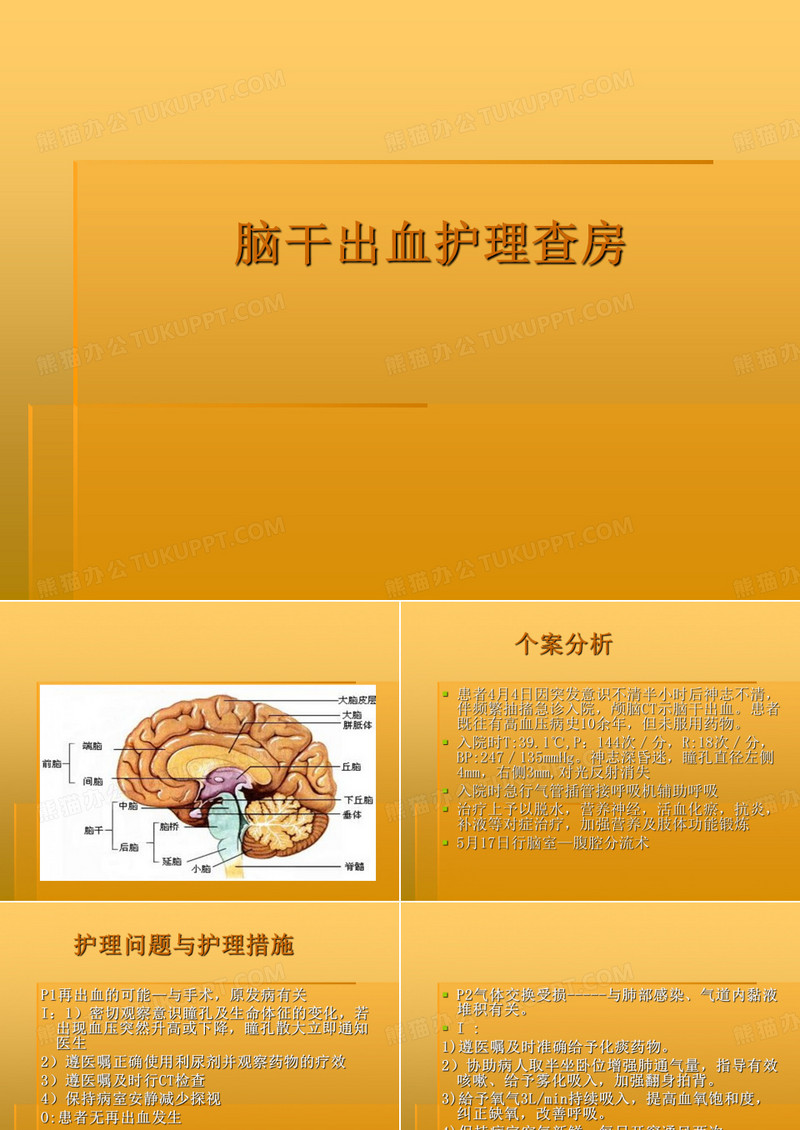 脑干出血护理查房