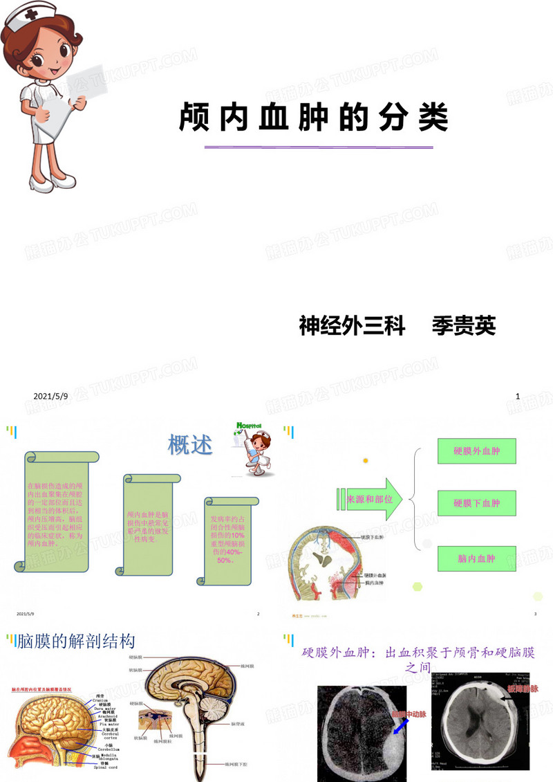 颅内血肿的分类