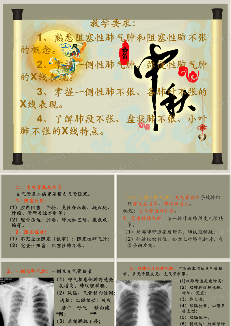 肺不张