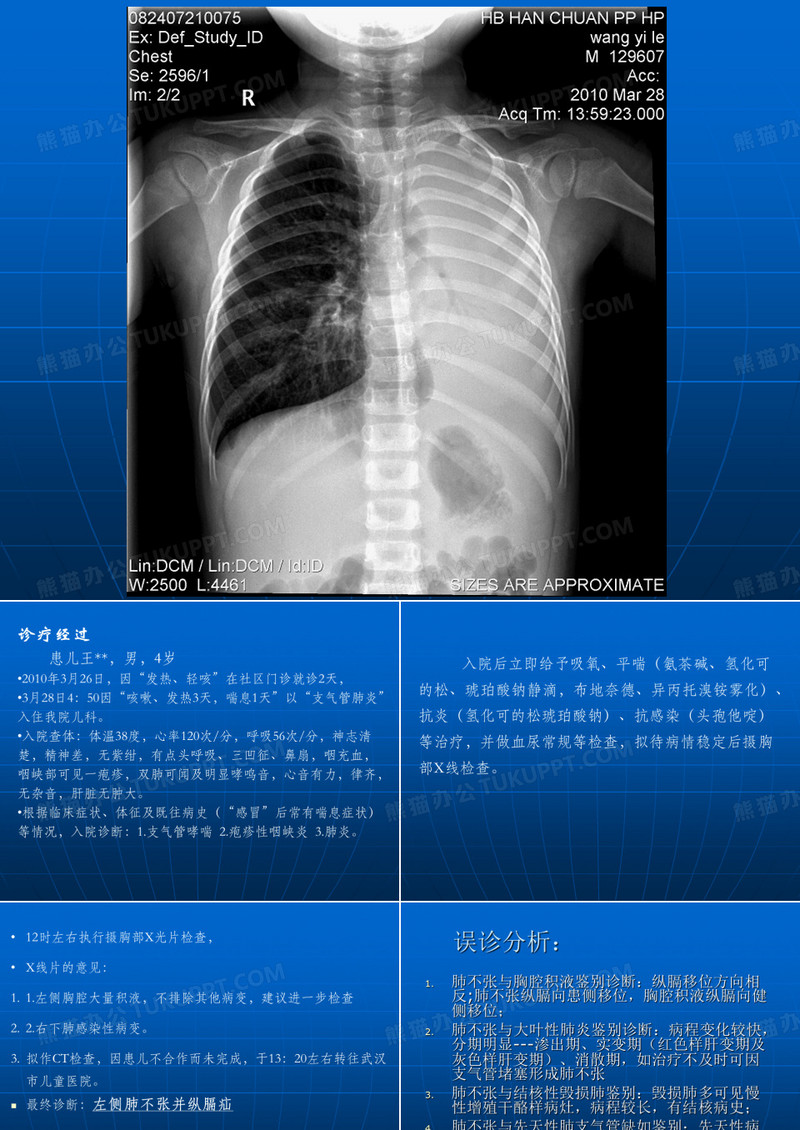 肺不张诊断及鉴别