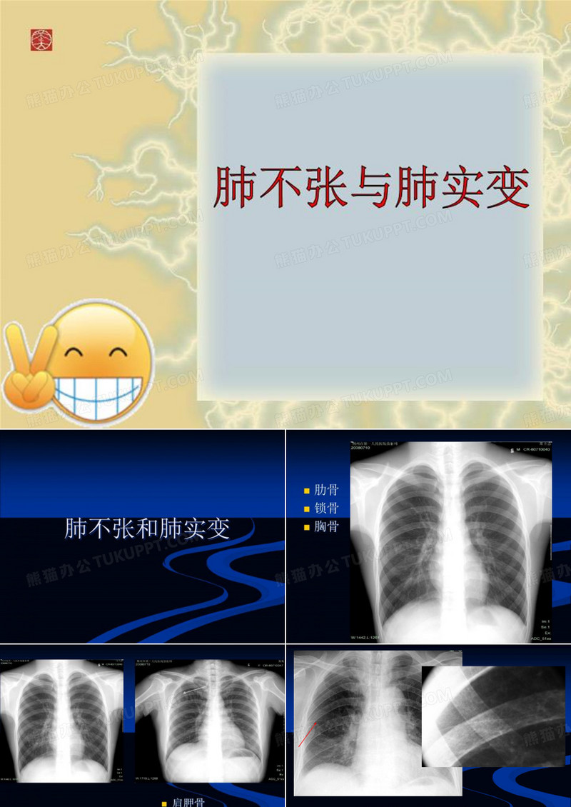 肺不张与肺实变