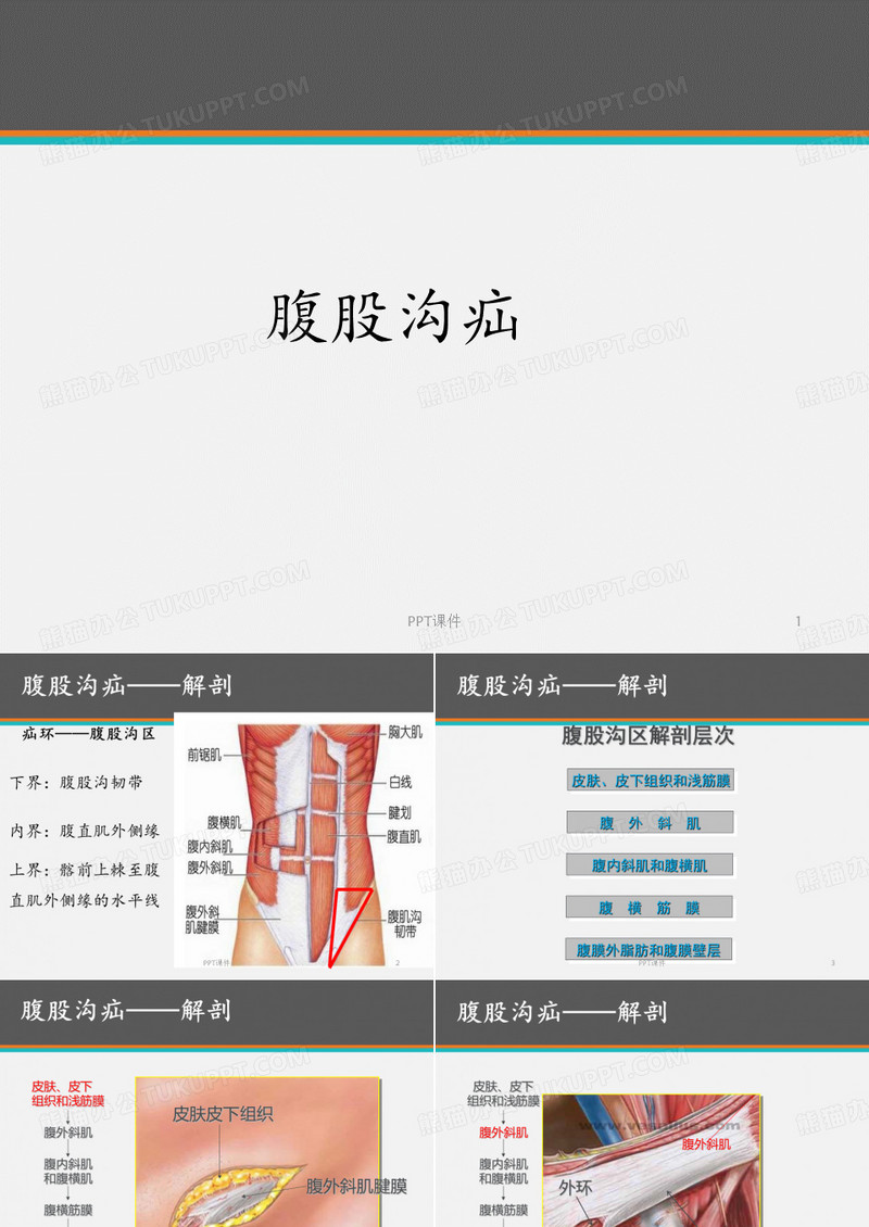 腹股沟疝  ppt课件