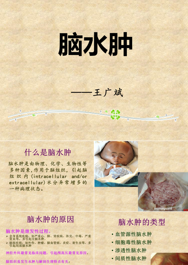 脑水肿