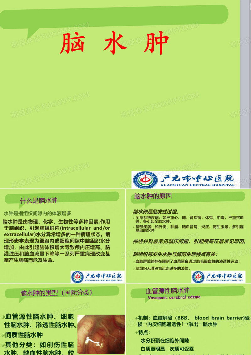 脑水肿