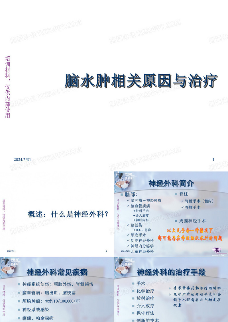 神经外科-脑水肿