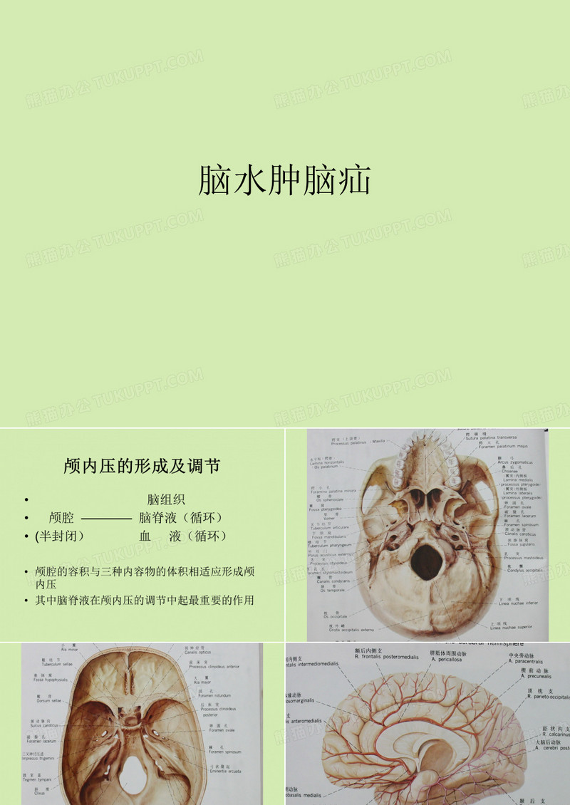 脑水肿脑疝【完整版】