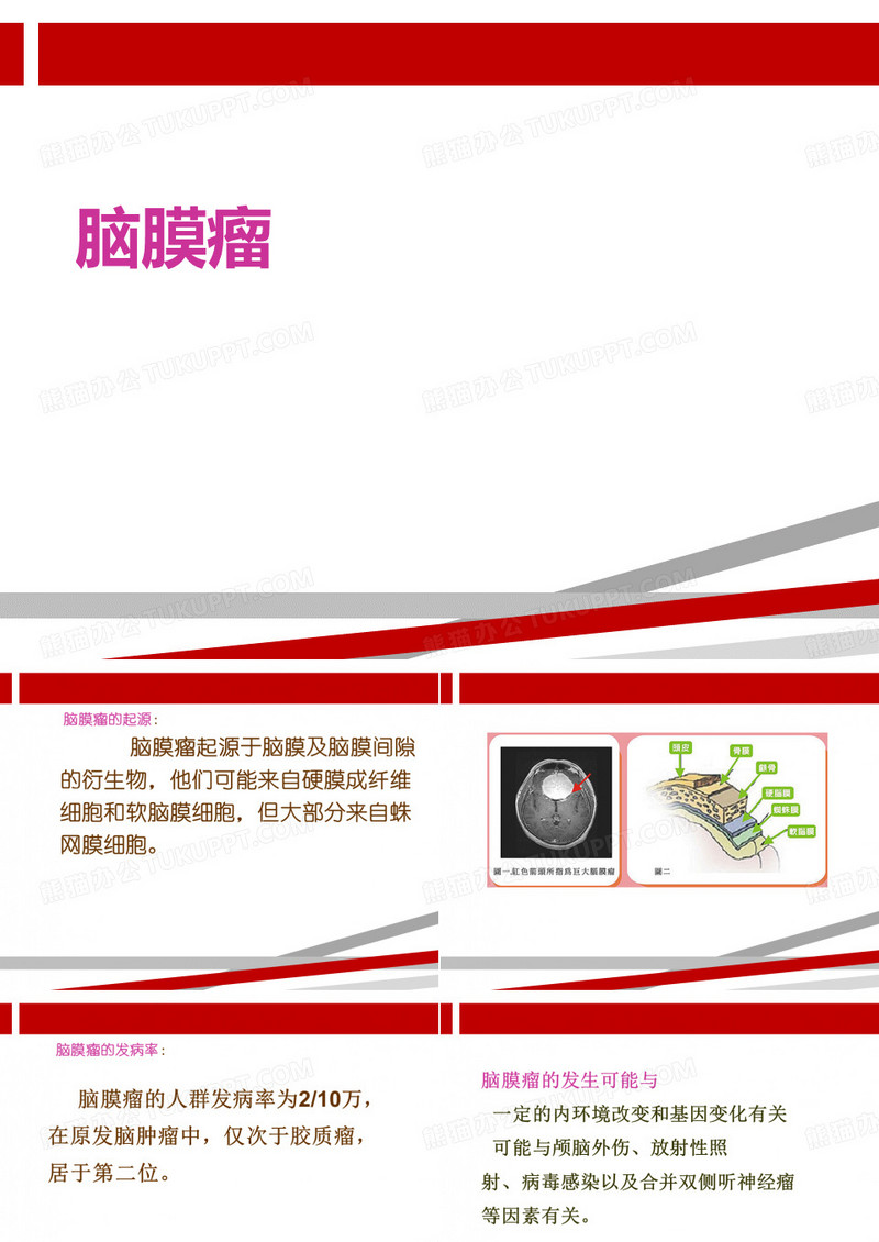 脑膜瘤.ppt