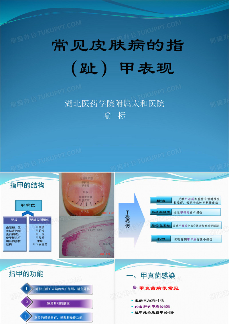 常见皮肤病的指甲表现