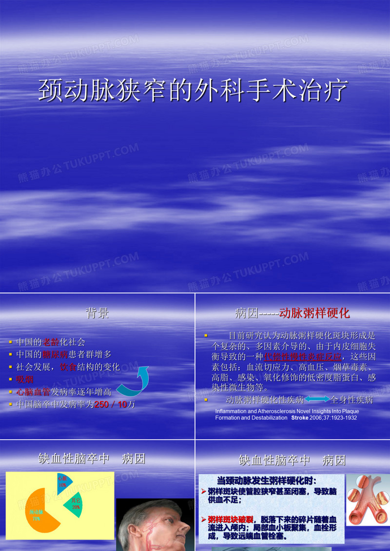 --颈动脉内膜剥脱术