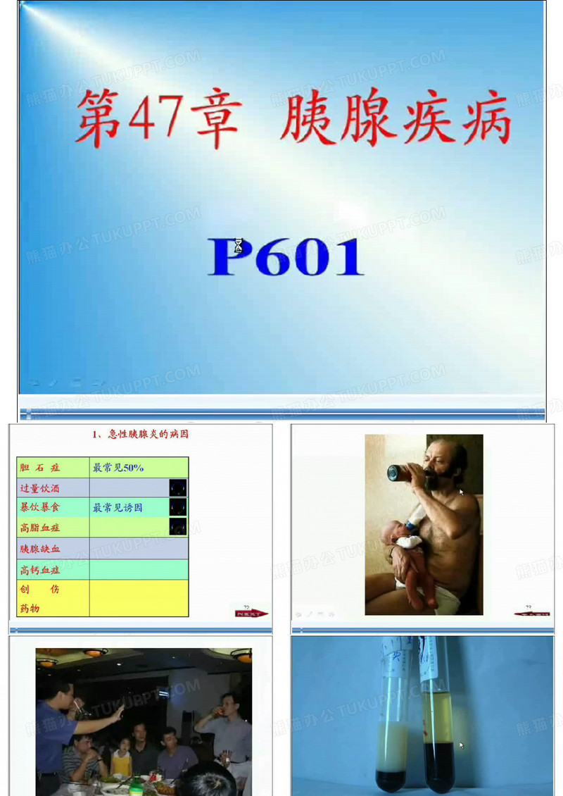 贺银成胰腺疾病