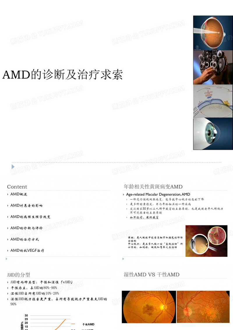 amd的诊断和治疗