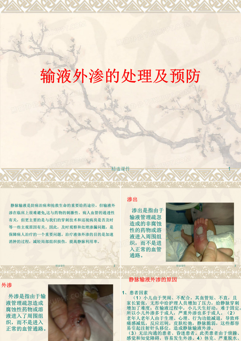 静脉输液外渗的护理