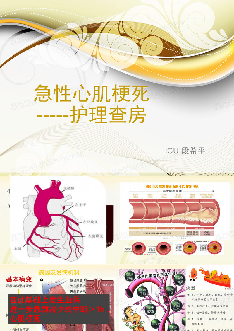 心肌梗塞护理查房