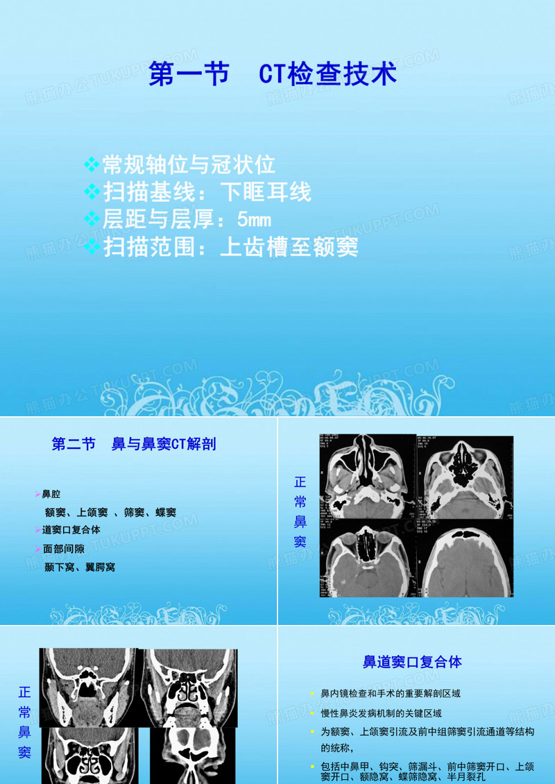 CT诊断学鼻与鼻窦CT