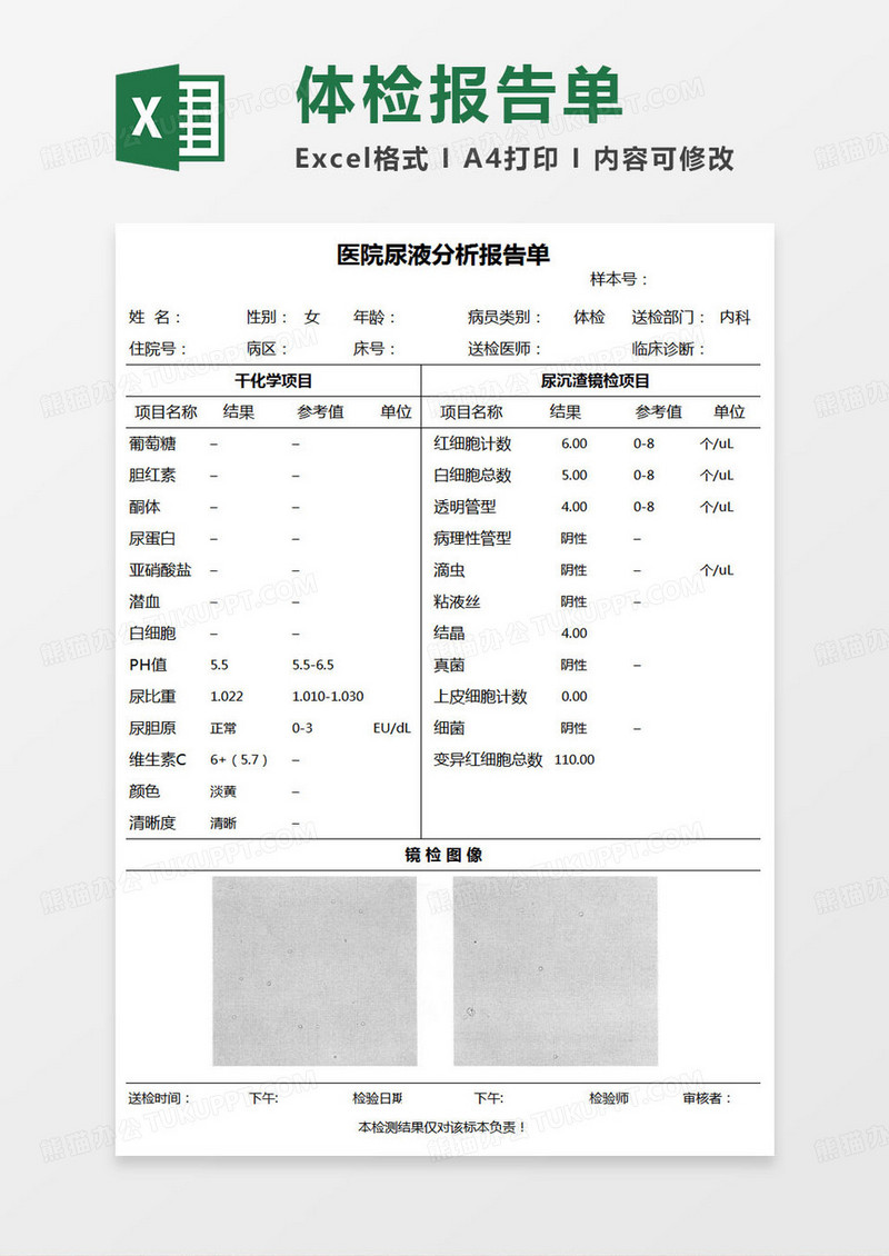 简约医院尿液分析报告单excel模版