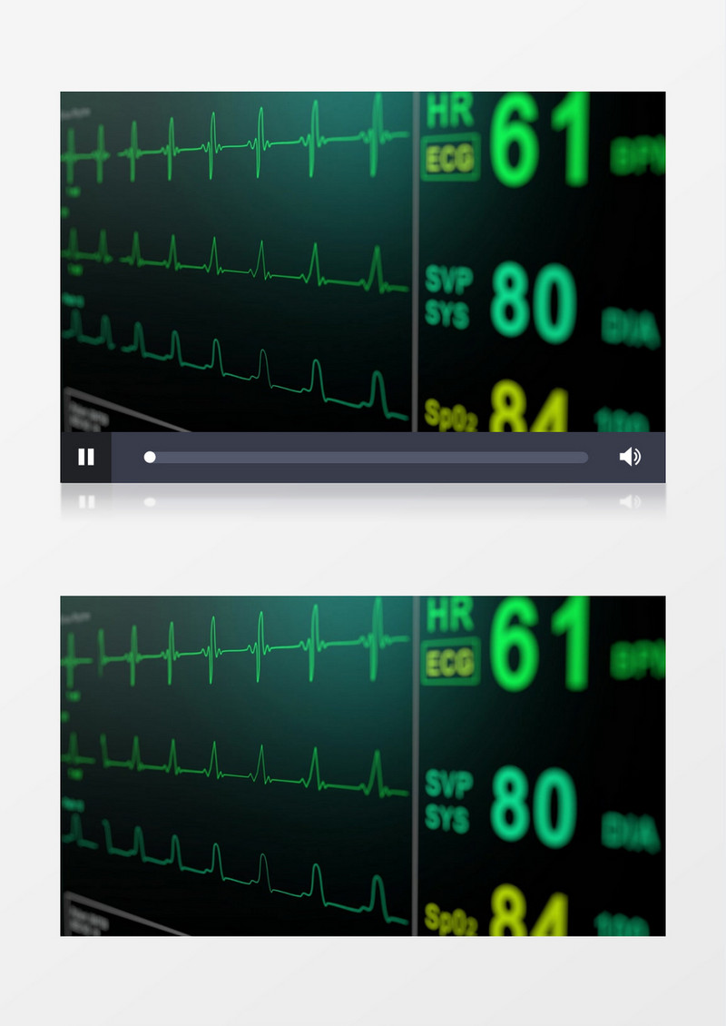 心电图调动实拍素材