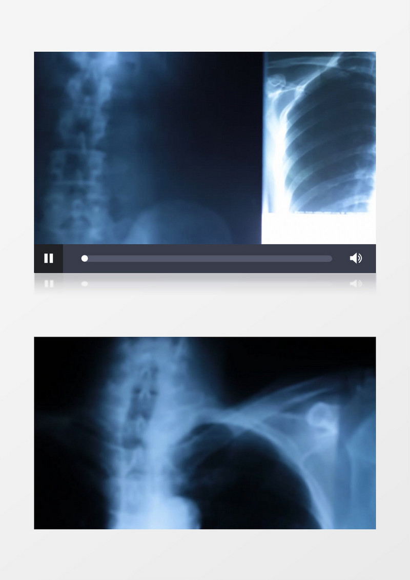 人体骨骼彩超实拍视频素材
